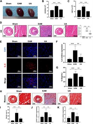 Ursolic acid reduces oxidative stress injury to ameliorate experimental autoimmune myocarditis by activating Nrf2/HO-1 signaling pathway